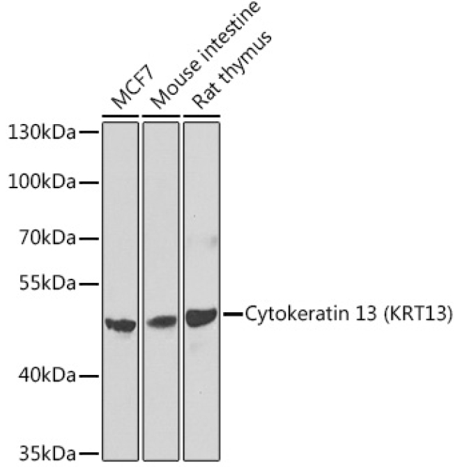 Cytokeratin 13 (KRT13) Rabbit Polyclonal Antibody