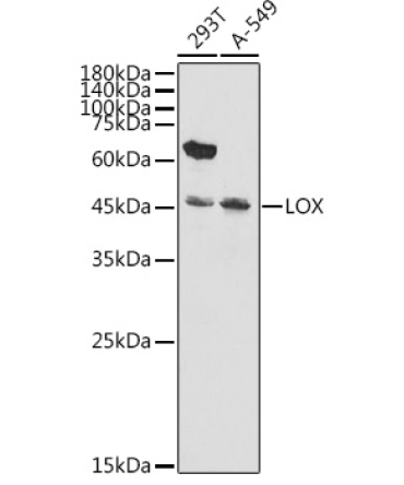 LOX Rabbit Polyclonal Antibody