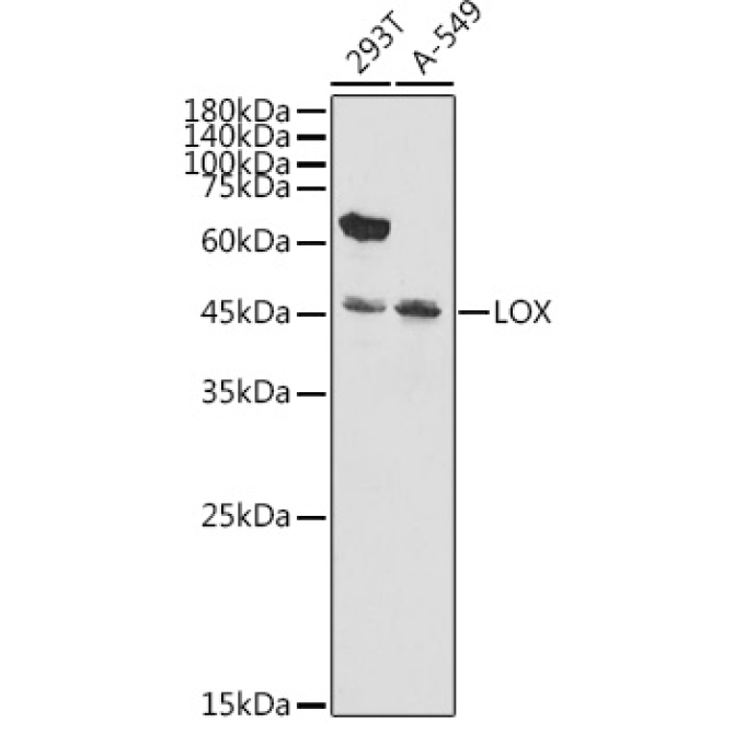 LOX Rabbit Polyclonal Antibody