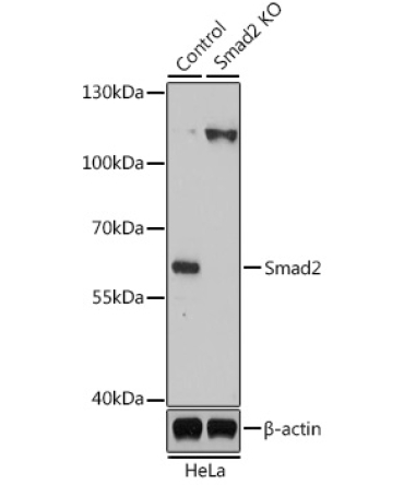 Smad2 Rabbit Polyclonal Antibody [KO Validated]