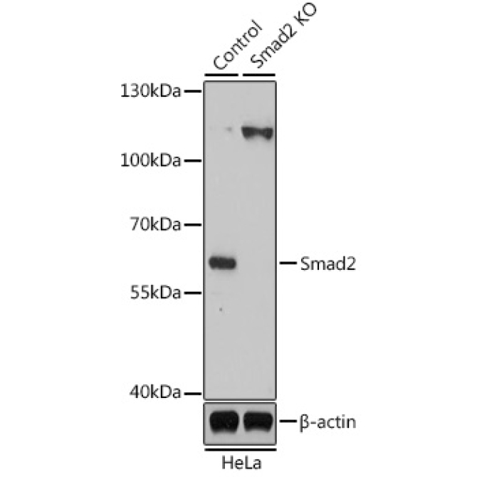 Smad2 Rabbit Polyclonal Antibody [KO Validated]