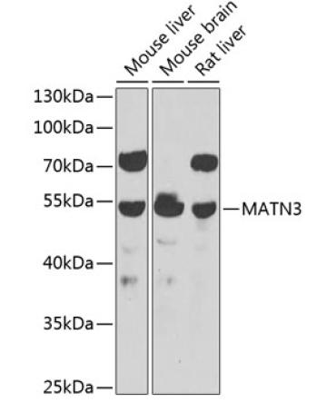 MATN3 Rabbit Polyclonal Antibody