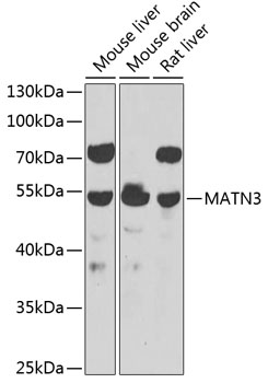 MATN3 Rabbit Polyclonal Antibody