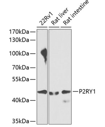 P2RY1 Rabbit Polyclonal Antibody