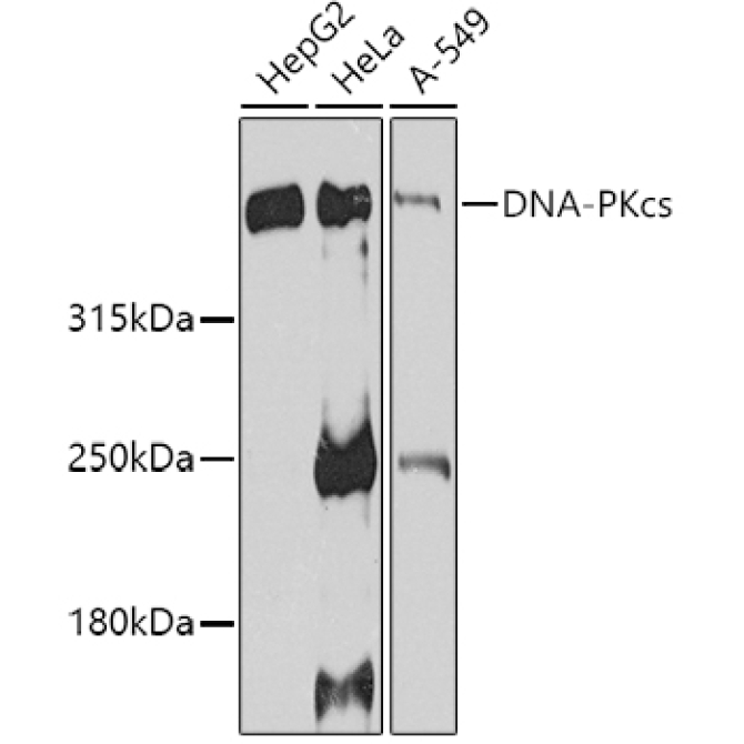 DNA-PKcs Rabbit Polyclonal Antibody