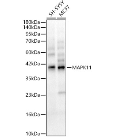 MAPK11 Rabbit Polyclonal Antibody
