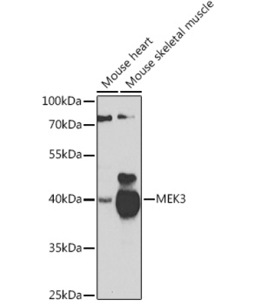 MEK3 Rabbit Polyclonal Antibody