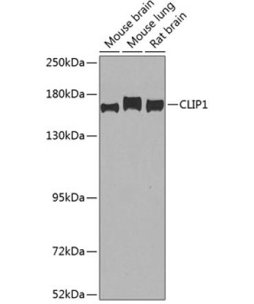 CLIP1 Rabbit Polyclonal Antibody