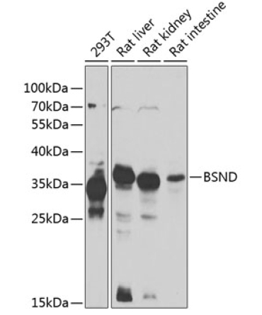 BSND Rabbit Polyclonal Antibody