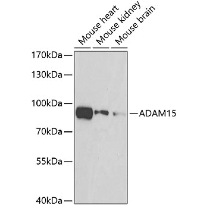 ADAM15 Rabbit Polyclonal Antibody