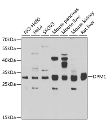 DPM1 Rabbit Polyclonal Antibody