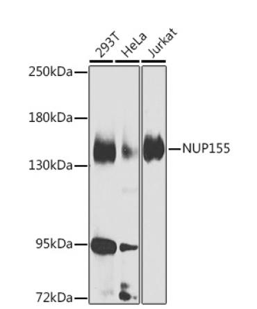 NUP155 Rabbit Polyclonal Antibody