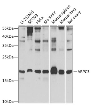 ARPC3 Rabbit Polyclonal Antibody