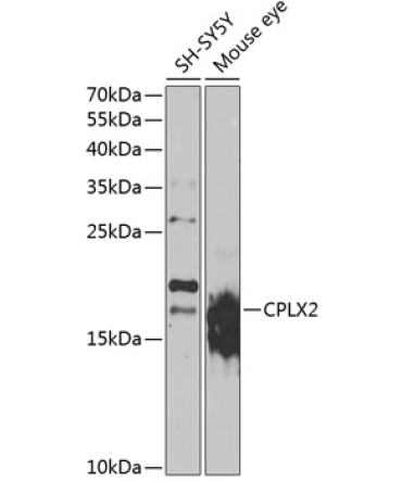 CPLX2 Rabbit Polyclonal Antibody