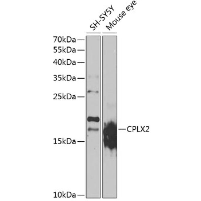 CPLX2 Rabbit Polyclonal Antibody