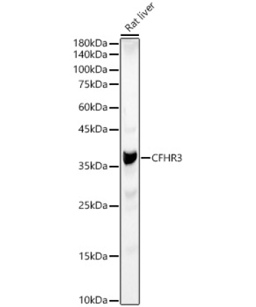 CFHR3 Rabbit Polyclonal Antibody