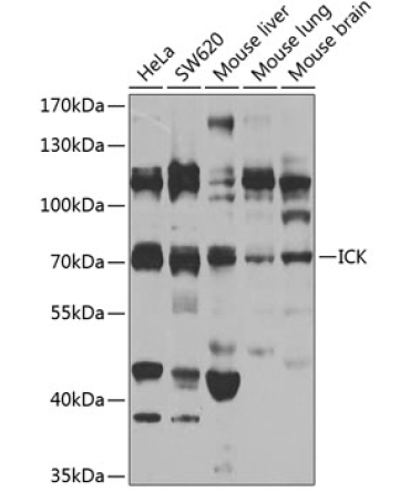 ICK Rabbit Polyclonal Antibody
