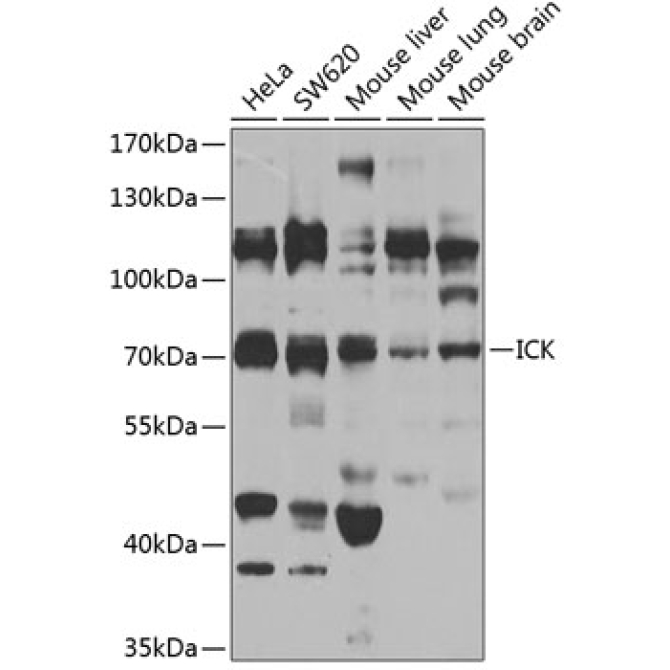 ICK Rabbit Polyclonal Antibody
