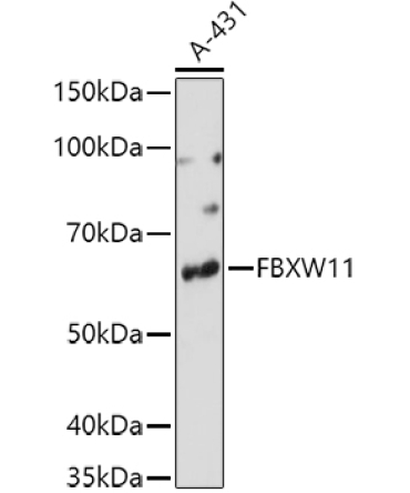 FBXW11 Rabbit Polyclonal Antibody