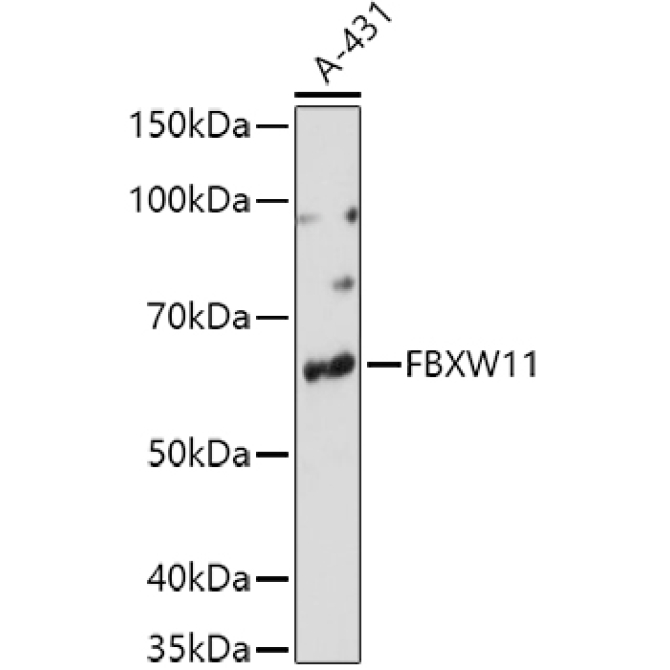 FBXW11 Rabbit Polyclonal Antibody
