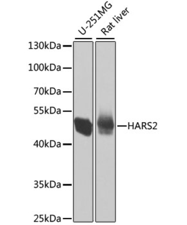 HARS2 Rabbit Polyclonal Antibody