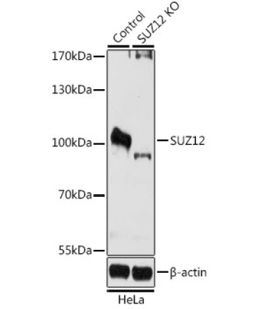 SUZ12 Rabbit Polyclonal Antibody [KO Validated]