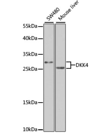 DKK4 Rabbit Polyclonal Antibody