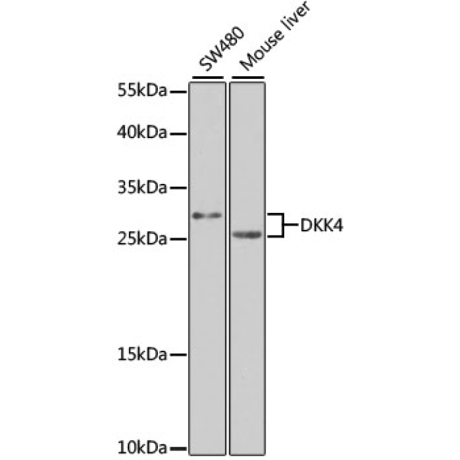 DKK4 Rabbit Polyclonal Antibody