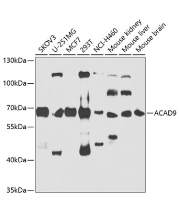 ACAD9 Rabbit Polyclonal Antibody