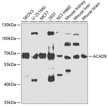 ACAD9 Rabbit Polyclonal Antibody