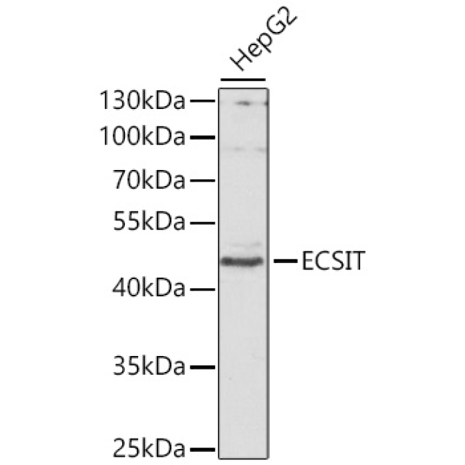 ECSIT Rabbit Polyclonal Antibody