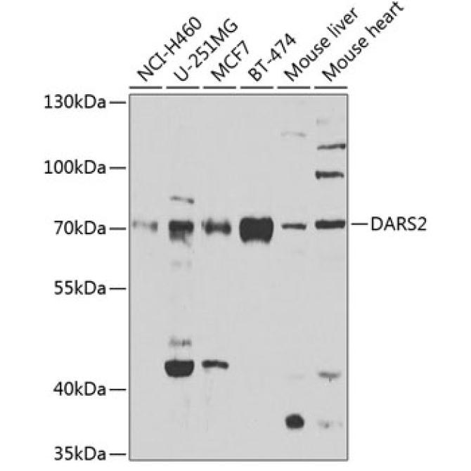 DARS2 Rabbit Polyclonal Antibody