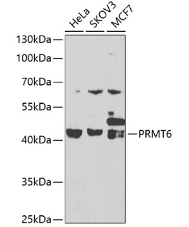 PRMT6 Rabbit Polyclonal Antibody [KO Validated]