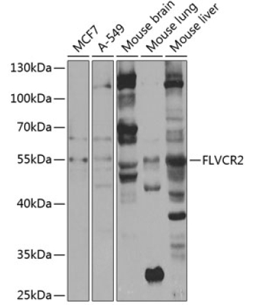 FLVCR2 Rabbit Polyclonal Antibody