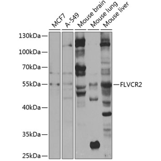 FLVCR2 Rabbit Polyclonal Antibody