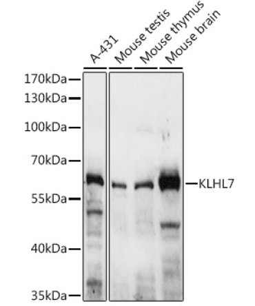 KLHL7 Rabbit Polyclonal Antibody