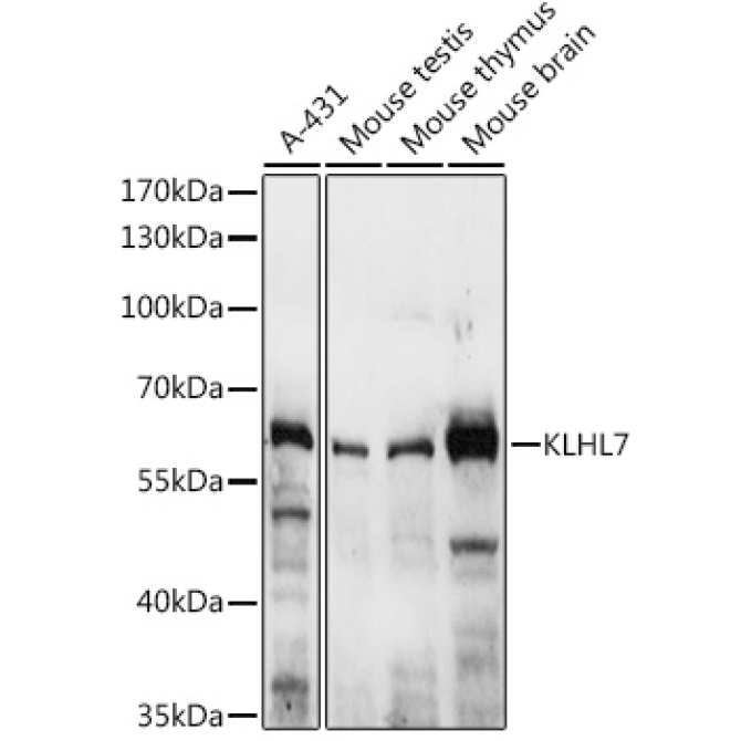 KLHL7 Rabbit Polyclonal Antibody