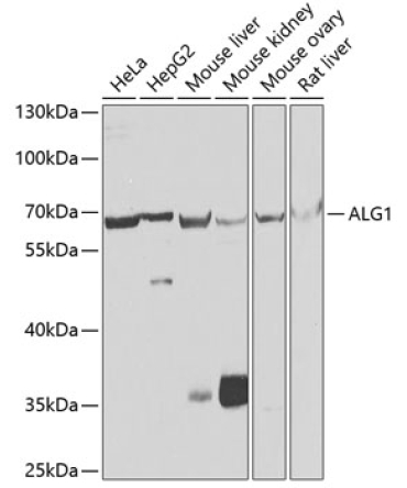 ALG1 Rabbit Polyclonal Antibody