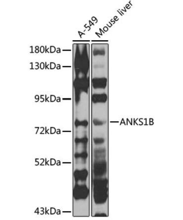 ANKS1B Rabbit Polyclonal Antibody