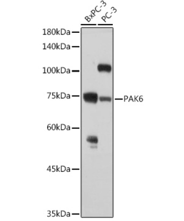 PAK6 Rabbit Polyclonal Antibody