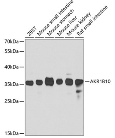 AKR1B10 Rabbit Polyclonal Antibody