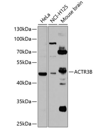 ACTR3B Rabbit Polyclonal Antibody