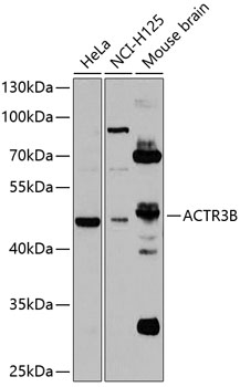 ACTR3B Rabbit Polyclonal Antibody