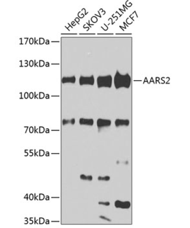 AARS2 Rabbit Polyclonal Antibody