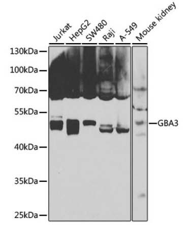 GBA3 Rabbit Polyclonal Antibody