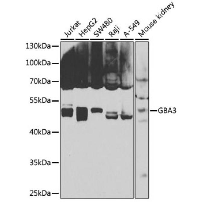 GBA3 Rabbit Polyclonal Antibody