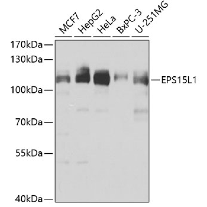 EPS15L1 Rabbit Polyclonal Antibody