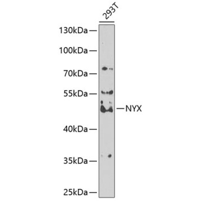 NYX Rabbit Polyclonal Antibody