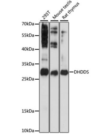 DHDDS Rabbit Polyclonal Antibody