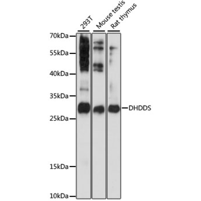 DHDDS Rabbit Polyclonal Antibody